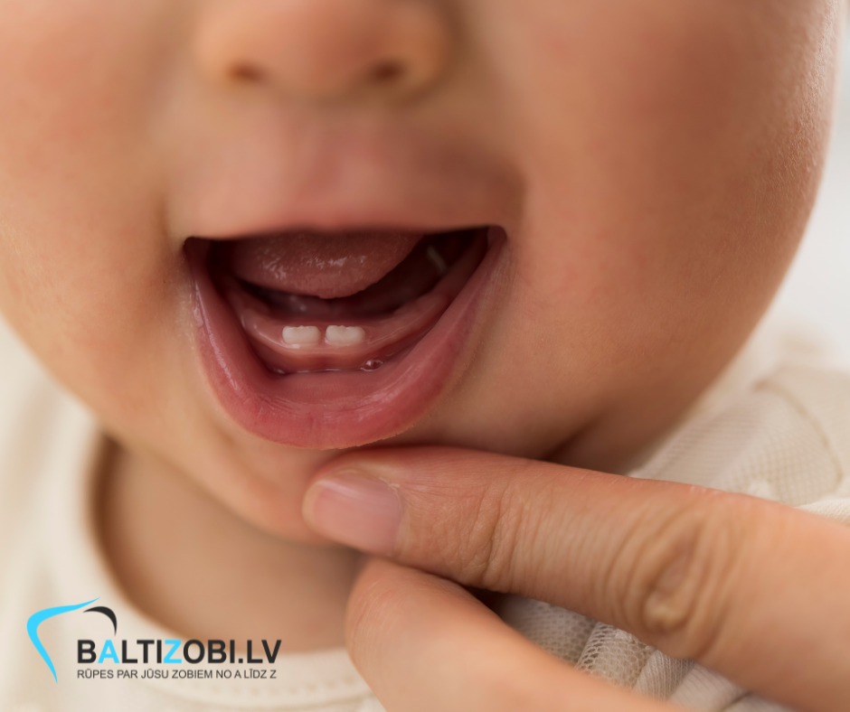 Kāpēc nepieciešama mutes kopšanas higiēna jaundzimušajiem
