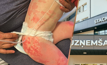 Aizbildņi, par piedzīvoto uzņemšanas nodaļā, ziņojuši Latvijas un Eiropas institūcijām. Jēkabpils slimnīcā uzsākta situācijas izvērtēšana